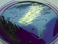 Bacteria